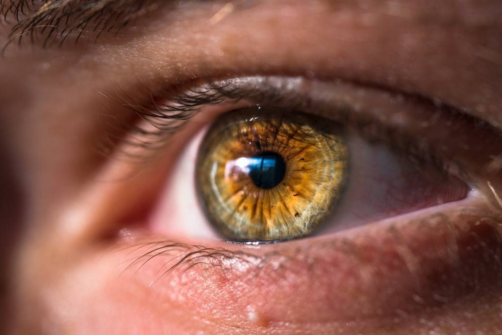 7 Steps to Get Insurance to Pay for Eyelid Surgery