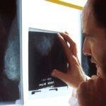 Cost of an X-Ray without Insurance
