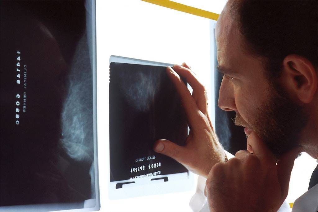 Cost of an X-Ray without Insurance