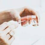 Does Dental Insurance Cover Implants