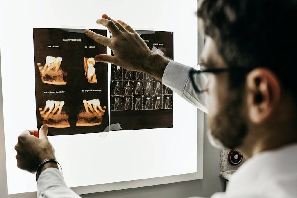 Does insurance cover wisdom teeth removal?