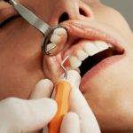 The Cost of Dental Cleaning Without Insurance