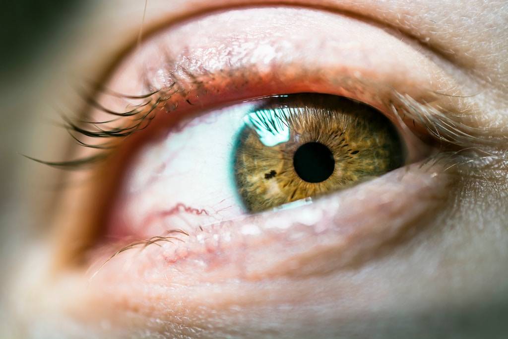 Does health insurance cover LASIK?