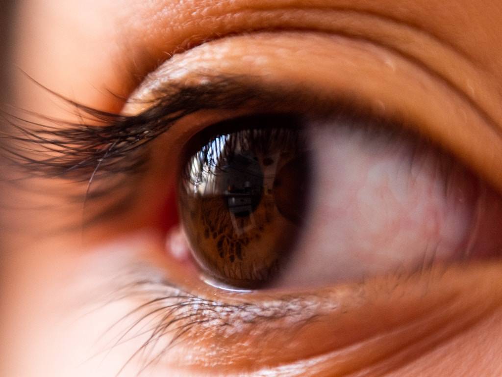 Does insurance cover LASIK?